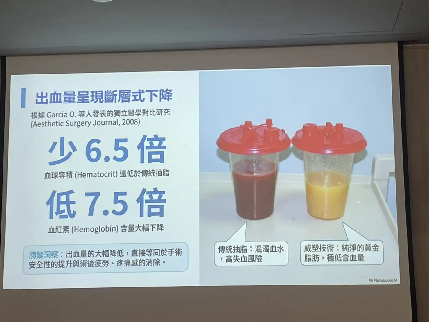 奇美醫院醫學美容中心暨整形外科主治醫師許翰平指出，威塑超音波氣泡脂雕系統可降低出血量與組織傷害，兼顧體態雕塑與術後恢復。(記者林怡孜攝)