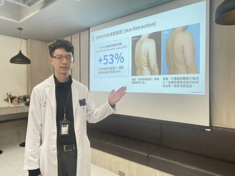 不只「抽脂」  身形雕塑新觀念   從減脂走向體態管理
