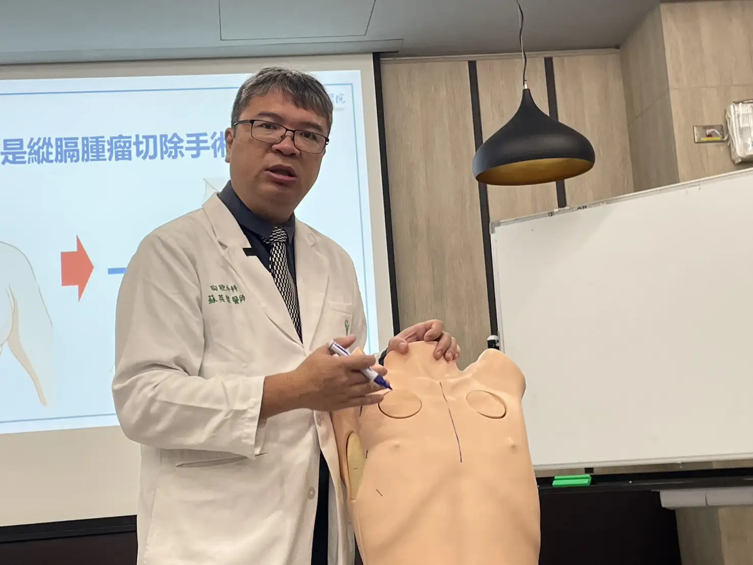 奇美醫院胸腔外科主任蘇英傑醫師說明「劍突下內視鏡入路」手術方式,透過胸骨下方中央小切口進入胸腔,結合達文西系統執行胸腺腫瘤切除,降低病患術後疼痛並縮短恢復期。(圖/記者林怡孜攝)